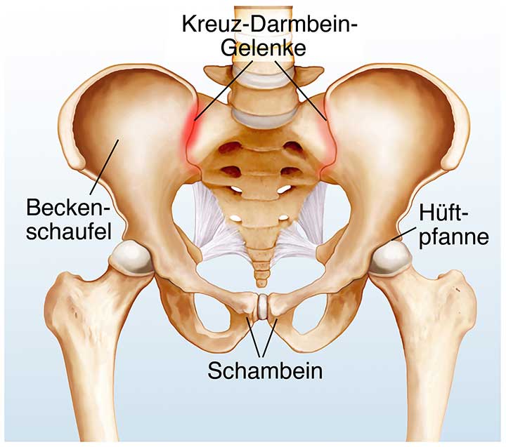 ISG Darstellung